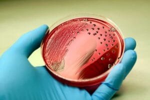 Salmonella Outbreak
