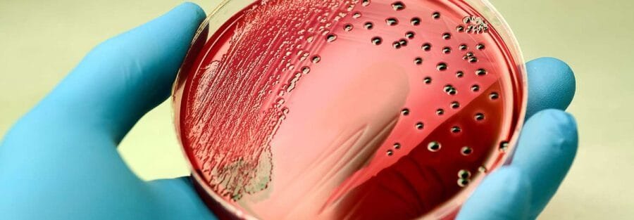 Salmonella Outbreak