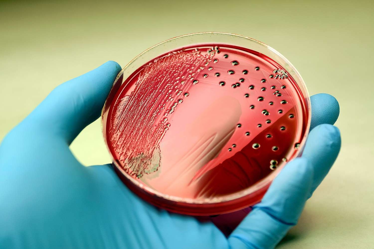Salmonella Outbreak